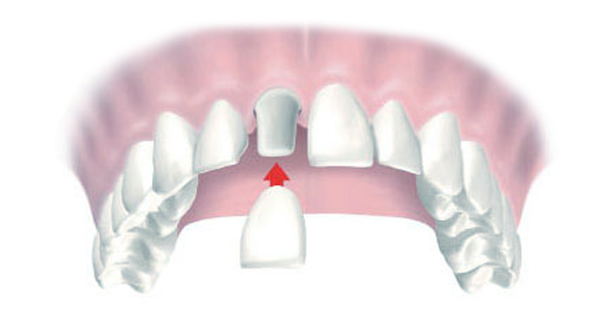 14-sartori-odontologia-dentista-esteio-sartori-consultorio-odontologico