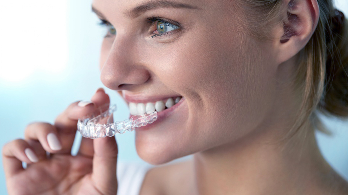 clareamento-dentes-caseiro-dentista-esteio-sartori-consultorio-odontologico